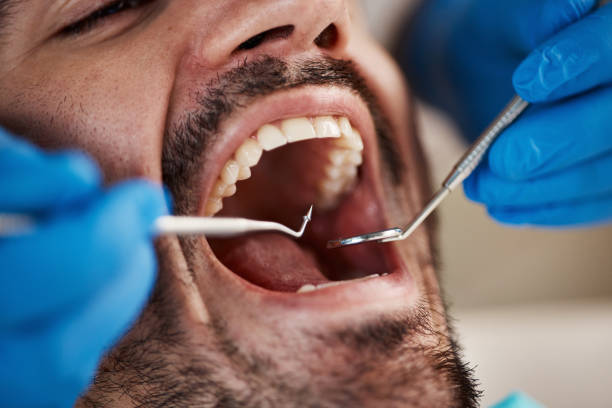 Best Emergency Gum Pain Relief  in Rossford, OH