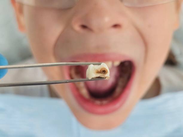 Best Broken Tooth Emergency  in Rossford, OH